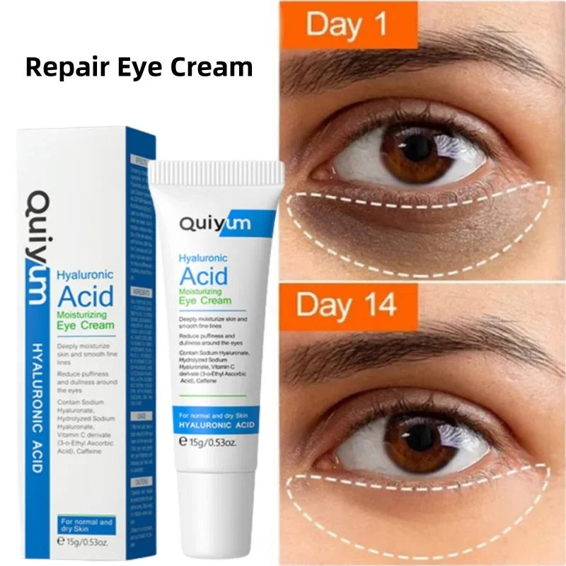 Eye Dark Circles Remover Cream Retinol Anti-aging Serum